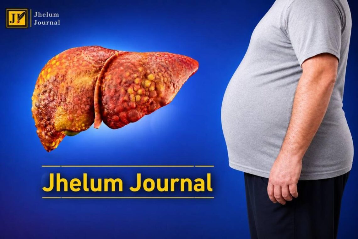 Fatty Liver Disease: Causes, Symptoms, Diet, Prevention and Treatment Explained.
