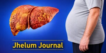 Fatty Liver Disease: Causes, Symptoms, Diet, Prevention and Treatment Explained.